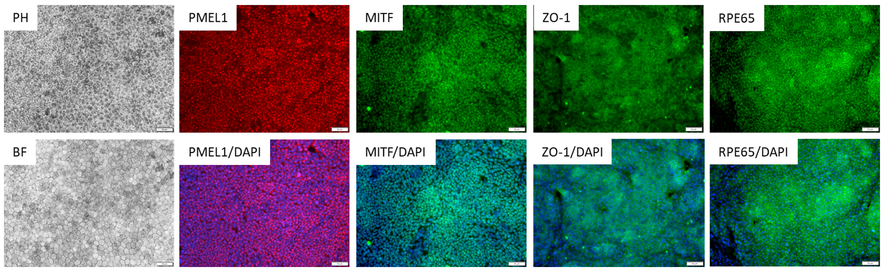 Ipsc Derived Human Retinal Pigment Epithelium Rpe Kit African