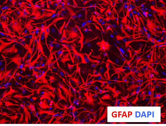 TECHNICAL-Astrocyte-GFAP-DAPi